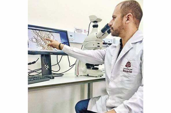 El doctor Edwin Cadena de la Universidad del Rosario en Bogotá lidera la investigación.