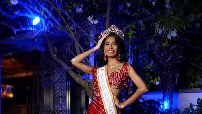 Fue una de las primeras mujeres con vitiligo en aspirar a participar en Miss Universo.